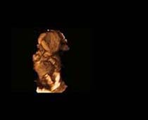 Échographie 3D de quatorze semaines Foetus