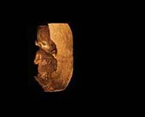 3D Ultrasound of First Trimester Fetus 2