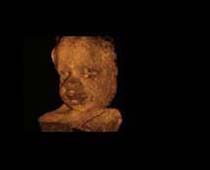 Échographie 3D de fœtale clip Visage 4