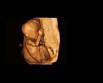 Échographie 3D de quatorze semaines Foetus 3