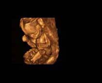Échographie 3D de Second Trimestre foetus 5
