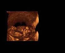 Échographie 3D de dix semaines Foetus