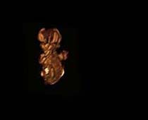 Échographie 3D de Premier Trimestre foetus 4