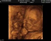 3D Fetal Behavior Ultrasound Scan Photos Slide Show