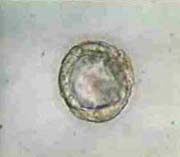 Blastocyst with different grading