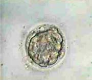 Compacted to Early Blastocyst