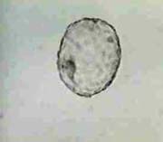 Completely Hatched Blastocyst