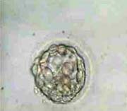 Early expanding Blastocyst