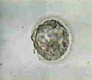 Early expanding Blastocyst