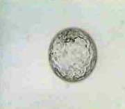 Expanded Blastocyst with clear inner cell mass