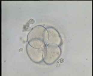 جنين 4 خلايا مكبر