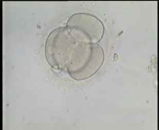 جنين 4 خلايا اليوم 2