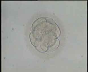 جنين 8 خلايا في اليوم 3