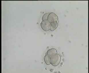 اجنة 4 خلايا