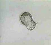 Hatching Blastocyst