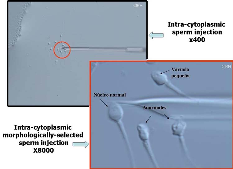 IMSI Magnification