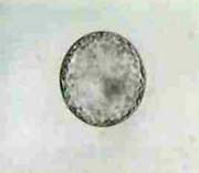 Less magnified Expanded Blastocyst