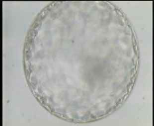 Magnified Expanded Blastocyst with clear Inner Cell Mass