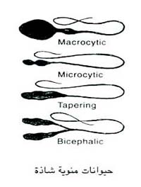 اشكال الحيوانات المنويه