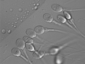 Sperm with vacuoles
