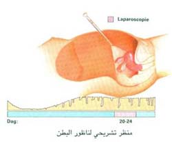 منظر تشريحي لناظور البطن