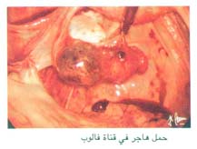 حمل هاجر في قناة فالوب