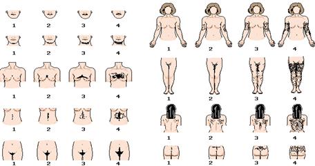 ظهور شعر خشن في مناطق مختلفة من جسم المرأة