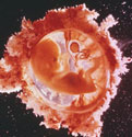11 weeks fetus