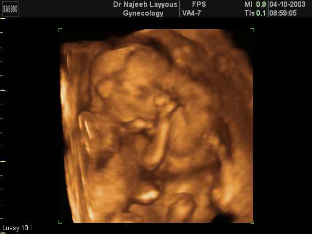 19 Weeks Fetus