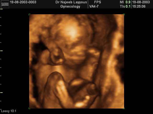 21 Weeks Fetus