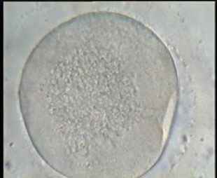 a mature Oocyte after injecting the immobilized sperm in it through the needle