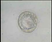 Blastocyst with different grading