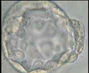 Blastocyst with very clear Inner Cell Mass