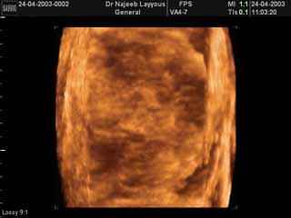 Normal Breast Tissue 3D