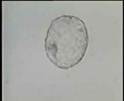Completely Hatched Blastocyst