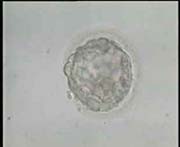 Early expanding Blastocyst