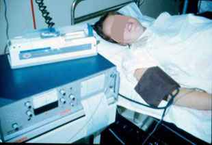 Epidural Procedure carried out by Dr. Najeeb Layyous in 1982