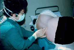 Epidural Procedure carried out by Dr. Najeeb Layyous in 1982