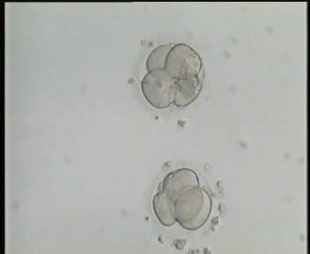 4-cell embryos