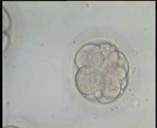 6-7 cells embryos