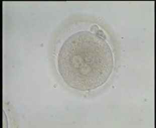 A fertilized egg non natural