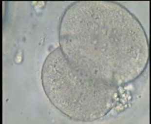 Embryo Bouklitin enlarged