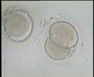 2-cell embryos