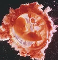 Staining the chromosomes using F.I.S.H