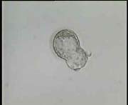 Hatching Blastocyst