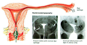 Color Doppler ultrasound