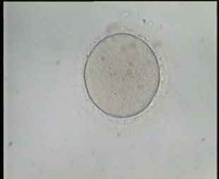 Immature Oocyte in Metaphase I Stage