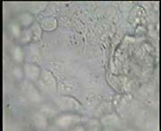 Inner Cell Mass of Blastocyst