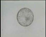 Less magnified Expanded Blastocyst