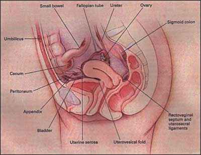 Location of Endometriosis